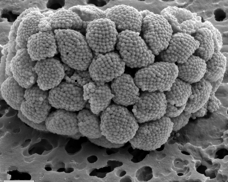 Представитель Семейства Zygosphaeraceae